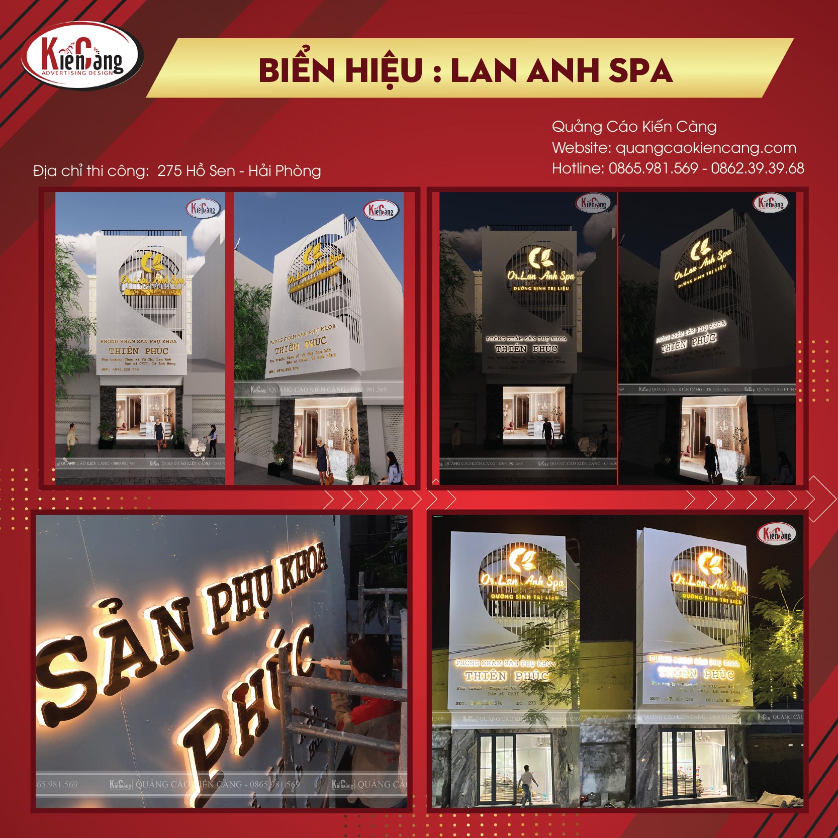 Top 10 mẫu biển hiệu thẩm mỹ viện, SPA đẹp xuất sắc tại Quảng Cáo Kiến Càng
